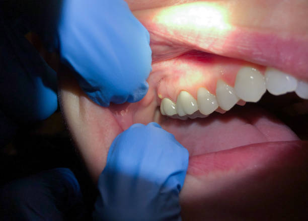 Best Emergency Dental Services for Seniors in Claysburg, PA